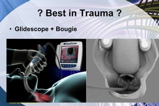? Best in Trauma ? Glidescope + Bougie Copyright  © 2007 ENA 