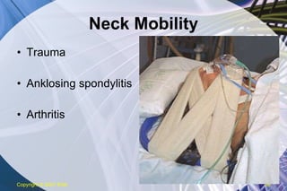 Neck Mobility Trauma Anklosing spondylitis Arthritis Copyright  © 2007 ENA 
