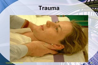 Trauma Copyright  © 2007 ENA 