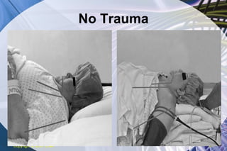 No Trauma Copyright  © 2007 ENA 