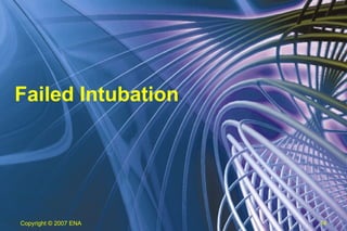Failed Intubation Copyright  © 2007 ENA 