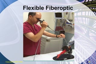 Flexible Fiberoptic Copyright  © 2007 ENA 
