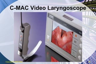 C-MAC Video Laryngoscope Copyright  © 2007 ENA 
