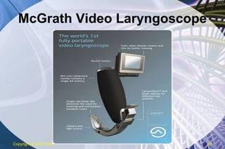 McGrath Video Laryngoscope Copyright  © 2007 ENA 