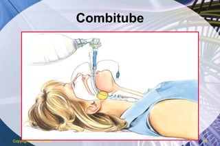 Combitube Copyright  © 2007 ENA 