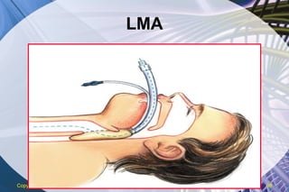 LMA Copyright  © 2007 ENA 