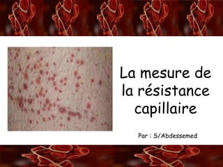 A/S
La rétraction du caillot
La mesure de
la résistance
capillaire
Par : S/Abdessemed
 