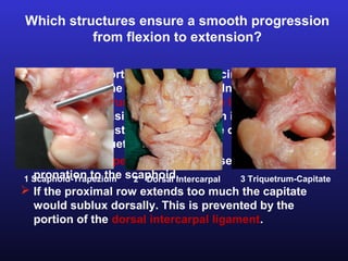 Which structures ensure a smooth progression
          from flexion to extension?

 The most important ligament inducing progressive
  extension of the proximal row in ulnar deviation is the
  palmar triquetrum-capitate-hamate ligament that
  increase in tension. The triquetrum is pulled by this
  ligament against the proximal pole of the hamate with
  which the triquetrum extends.
 The scaphotrapezial ligament causes extension and
1 Scaphoid-Trapezium scaphoid.
  pronation to the 2 Dorsal Intercarpal  3 Triquetrum-Capitate
 If the proximal row extends too much the capitate
  would sublux dorsally. This is prevented by the
  portion of the dorsal intercarpal ligament.
 