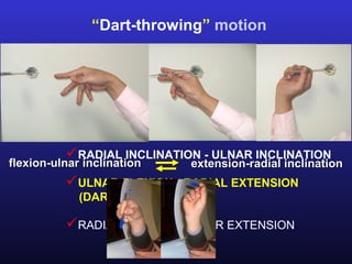 “Dart-throwing” motion

                  Carpal kinematics



          FLEXION - EXTENSION
          RADIAL INCLINATION - ULNAR INCLINATION
flexion-ulnar inclination      extension-radial inclination
          ULNAR FLEXION - RADIAL EXTENSION
             (DART-THROWING)

          RADIAL FLEXION - ULNAR EXTENSION
 