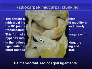 Radiocarpal- midcarpal clunking

 The pattern of clunking is similar to the anterior
  midcarpal instability but adding an increased mobility at
  the RC joint implying an abnormally flexed and ulnarly
  translocated proximal row in radial deviation.
 This form of clunking is frequent among teenagers with
  hyperlax radio-ulno-carpal ligaments.
 In the radiocarpal (or proximal) type of clunking, the
  ligaments mostly involved are the palmar long and
  short radiolunate and the dorsal radiotriquetral.



        Palmar-dorsal radiocarpal ligaments
 