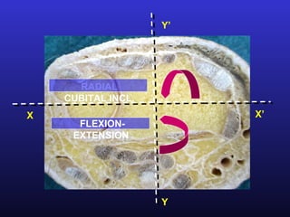 Y’




      RADIAL
    CUBITAL INCL.
X                        X’
      FLEXION-
     EXTENSION




                    Y
 
