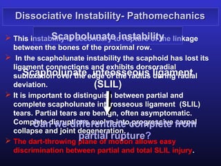Dissociative Instability- Pathomechanics

              Scapholunate instability
 This instability is secondary to rupture of the linkage
  between the bones of the proximal row.
 In the scapholunate instability the scaphoid has lost its
  ligament connections and exhibits dorsoradial
  subluxation over the edge of the radius ligament
      Scapholunate inteosseous during radial
  deviation.               (SLIL)
 It is important to distinguish between partial and
  complete scapholunate interosseous ligament (SLIL)
  tears. Partial tears are benign, often asymptomatic.
  Complete disruptions evolve intocomplete from
         Can we differentiate progressive carpal
  collapse and joint degeneration.
                       partial rupture?
 The dart-throwing plane of motion allows easy
  discrimination between partial and total SLIL injury.
 