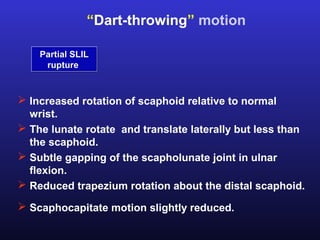 “Dart-throwing” motion

    Partial SLIL
     rupture



 Increased rotation of scaphoid relative to normal
  wrist.
 The lunate rotate and translate laterally but less than
  the scaphoid.
 Subtle gapping of the scapholunate joint in ulnar
  flexion.
 Reduced trapezium rotation about the distal scaphoid.
 Scaphocapitate motion slightly reduced.
 