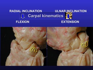 RADIAL INCLINATION         ULNAR INCLINATION
          Carpal kinematics
   FLEXION                    EXTENSION


    FLEXION - EXTENSION
    RADIAL INCLINATION - ULNAR INCLINATION
    ULNAR FLEXION - RADIAL EXTENSION
    RADIAL FLEXION - ULNAR EXTENSION
 