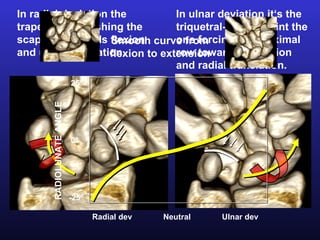 In radial deviation the           In ulnar deviation it‘s the
trapezium is pushing the          triquetral-hamate joint the
scaphoid towards flexion curve from
                    Smooth        one forcing the proximal
and ulnar translation.            row towards extension
                    flexion to extension
                                  and radial translation.
                           25º
       RADIOLUNATE ANGLE




                           0º




                           -25º

                                  Radial dev   Neutral   Ulnar dev
 