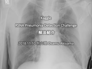 2018.11.10 秋山理 Osamu Akiyama
Kaggle
RSNA Pneumonia Detection Challenge
解法紹介
 
