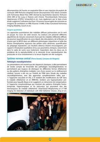 29
décomposition de Fourier, en respiration libre et sans injection de produit de
contraste (MRI Perfusion-weighted Fourier Decomposition (FD) Values Correlate
with Pulmonary Blood Flow (PBF) Derived by Quantitative Dynamic Perfusion
(DCE) MRI of the Lung in Patients with Chronic Thromboembolic Pulmonary
Hypertension (CTEPH), Schoenfeld et al.), mais également par le biais d’une
étude suggérant l’utilisation du Fluor 19 comme nouvel agent de contraste en
imagerie de ventilation en IRM (Fluorine-19 MRI: A New Functional Pulmonary
Imaging Modality, Couch et al.).
Imagerie quantitative
Les approches quantitatives des maladies diffuses pulmonaires ont le vent
en poupe. Au cours de cette session, les orateurs ont présenté différents
algorithmes de mesures concernant d’une part les maladies infiltrantes diffuses
du poumon (quantification du verre dépoli, des réticulations, de la fibrose), et
d’autre part la BPCO dans ses différents phénotypes (répartition et taille des
lésions d’emphysème, épaisseur des petites voies aériennes, quantification
du piégeage expiratoire). Les résultats obtenus étaient encourageants, par
rapport à l’évaluation qualitative et/ou aux paramètres cliniques, notamment
dans le cadre de suivis sous traitement. Cependant, dans les deux cas, le
problème de la reproductibilité et la nécessité d’une standardisation des
protocoles et d’un entraînement à la tenue d’apnée ont été soulignés.
Système nerveux central (Pierre Durand, Constance de Margerie)
Pathologies neurodégénératives
Les présentations ont montré que des séquences classiques, si elles permettaient
de rendre compte de l’ensemble des pathologies neurodégénératives ne
permettaient pas toujours de distinguer les différentes formes d’Alzheimer
ou des patterns d’atrophies multiples. Lors d’une session sur le vieillissement
cérébral, l’accent a été mis sur l’intérêt de l’IRM dans l’étude des maladies
neurodégénératives, avec des approches complémentaires telles que :
1/ l’approche vasculaire en ASL à 3T révélant des modifications du CBF dans
la maladie d’Alzheimer et en IRMf/ASL révélant une hyperactivation pré-
frontale pour laquelle Beyea et al. suggèrent un mécanisme de compensation.
2/ l’approche morphométrique qui montrait des patterns  d’atrophie fronto-
temporale, hippocampique et du précunéus qui pourraient être des
biomarqueurs de maladie d’Alzheimer (Voxel-based Morphometry at 3-T MR
Imaging for Detection of Individuals with Mild Alzheimer Disease, Zeng et al.).
 