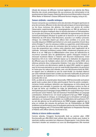 30
N° 16 Avril 2014
L’étude des tenseurs de diffusion montrait également une atteinte des fibres
blanches des circuits anatomiques liés aux processus de mémorisation et de
positionnement dans l’espace (Detecting Microstructural Abnormality in Gray and
White Matter of Alzheimer’s Disease Diffusional Kurtosis Imaging, Leung et al.).
Tumeurs cérébrales : nouvelles techniques
Session consacrée aux corrélations entre des données d’imagerie (perfusion et
prise de contraste, diffusion) et des données génomiques et transcriptomiques
sur les tissus tumoraux des gliomes. Ces études ont permis de corréler
l’observation expérimentale de la néoangiogénèse en IRM de perfusion et
l’expression de gènes impliqués dans la néovascularisation et l’hématopoïèse.
Sur un plan plus clinique, de nouvelles méthodes de segmentation du volume
tumoral permettaient d’évaluer la qualité de la résection et en particulier de
l’obtention du GTR (Gross Total Resection), associée à un meilleur pronostic
clinique. Ces méthodes étaient par ailleurs bien corrélées à la survie. Une
nouvelle séquence (VISIBLE) permettant en une seule acquisition d’avoir deux
séries d’images T1 avec les vaisseaux visibles ou supprimés, serait intéressante
pour la recherche des prises de contrastes dans les tumeurs de bas grade.
L’une des propositions qui a retenu notre attention était l’application de la
méthode intravoxel incohérent motion (IVIM), initialement proposée par Le
Bihan et al. en 1988 pour la différentiation entre zones de radionécrose et
récurrence tumorale dans les glioblastomes opérés (Histogram Analysis of
Intravoxel Incoherent Motion in Patients with Recurrent Glioblastoma: Initial
Experience, Kim et al.). Cette méthode repose sur la réalisation de séquences
de diffusion pour de multiples valeurs de b (0 à 2000), la courbe d’ADC ainsi
obtenue présente deux composantes linéaires, l’une pour de faibles valeurs
de b, qui montre une décroissance rapide du signal (ADC rapide) en rapport
avec la microvascularisation au sein du voxel étudié (équivalent à la perfusion)
et l’autre pour les valeurs de b élevées, avec une décroissance lente de l’ADC,
en rapport avec la cellularité au sein du voxel étudié. Les résultats obtenus
par cette méthode étaient bien corrélés aux données habituelles de perfusion
après injection de Gadolinium et à l’évolution radiologique de la zone péri-
tumorale (Kim et al).
Enfin, au-delà de la caractérisation lésionnelle, l’IRM fonctionnelle (activation)
garde toute sa place dans le bilan préchirurgical. Parmi les points soulignés :
certaines limites pratiques (attention aux hyposignaux en écho planar post
opératoire par exemple), la question du seuil statistique continu ou fixe, et
le type de tâche, qui modifient les index de latéralisation de dominance
hémisphérique pour le langage (UsageoffMRIforPre-surgicalPlanninginTumor
and Vascular Lesion Patients: Task and Statistical Threshold Effects on Language
Lateralization, Andreoli et al.). Un travail soulignait le fait que l’IRMf langage,
telle que pratiquée en clinique, ne remplaçait pas la stimulation corticale per
opératoire, car manquant de sensibilité. Les modifications de la perfusion (T2*)
au sein des gliomes sur les performances de l’IRMf langage, suggérant que la
prise en compte des mesures de perfusion lors de l’interprétation de l’IRMf
améliorera ses performances pour la localisation précise des aires fonctionnelles
(Language Mapping with 3T Functional MRI: Application to Preoperative Planning
of Patients with Diffuse Gliomas, Kuchcinski et al.).
Infarctus et réserve cérébro-vasculaire
Comme attendu, l’imagerie fonctionnelle était au premier plan. L’IRM
fonctionnelle par effet BOLD était utilisée dans deux études pour évaluer la
réactivité cérébro-vasculaire lors d’épreuve d’hypercapnie. L’une d’entre elles
cherchait à étudier ses variations au cours du développement. Elle montrait
 