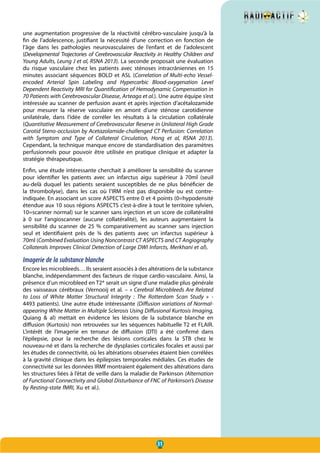 31
une augmentation progressive de la réactivité cérébro-vasculaire jusqu’à la
fin de l’adolescence, justifiant la nécessité d‘une correction en fonction de
l’âge dans les pathologies neurovasculaires de l’enfant et de l’adolescent
(Developmental Trajectories of Cerebrovascular Reactivity in Healthy Children and
Young Adults, Leung J et al, RSNA 2013). La seconde proposait une évaluation
du risque vasculaire chez les patients avec sténoses intracrâniennes en 15
minutes associant séquences BOLD et ASL (Correlation of Multi-echo Vessel-
encoded Arterial Spin Labeling and Hypercarbic Blood-oxygenation Level
Dependent Reactivity MRI for Quantification of Hemodynamic Compensation in
70 Patients with Cerebrovascular Disease, Arteaga et al.). Une autre équipe s’est
intéressée au scanner de perfusion avant et après injection d’acétalozamide
pour mesurer la réserve vasculaire en amont d’une sténose carotidienne
unilatérale, dans l’idée de corréler les résultats à la circulation collatérale
(Quantitative Measurement of Cerebrovascular Reserve in Unilateral High Grade
Carotid Steno-occlusion by Acetazolamide-challenged CT Perfusion: Correlation
with Symptom and Type of Collateral Circulation, Hong et al, RSNA 2013).
Cependant, la technique manque encore de standardisation des paramètres
perfusionnels pour pouvoir être utilisée en pratique clinique et adapter la
stratégie thérapeutique.
Enfin, une étude intéressante cherchait à améliorer la sensibilité du scanner
pour identifier les patients avec un infarctus aigu supérieur à 70ml (seuil
au-delà duquel les patients seraient susceptibles de ne plus bénéficier de
la thrombolyse), dans les cas où l’IRM n’est pas disponible ou est contre-
indiquée. En associant un score ASPECTS entre 0 et 4 points (0=hypodensité
étendue aux 10 sous régions ASPECTS c’est-à-dire à tout le territoire sylvien,
10=scanner normal) sur le scanner sans injection et un score de collatéralité
à 0 sur l’angioscanner (aucune collatéralité), les auteurs augmentaient la
sensibilité du scanner de 25 % comparativement au scanner sans injection
seul et identifiaient près de ¾ des patients avec un infarctus supérieur à
70ml (Combined Evaluation Using Noncontrast CT ASPECTS and CT Angiography
Collaterals Improves Clinical Detection of Large DWI Infarcts, Merkhani et al).
Imagerie de la substance blanche
Encore les microbleeds… Ils seraient associés à des altérations de la substance
blanche, indépendamment des facteurs de risque cardio-vasculaire. Ainsi, la
présence d’un microbleed en T2* serait un signe d’une maladie plus générale
des vaisseaux cérébraux (Vernooij et al. – « Cerebral Microbleeds Are Related
to Loss of White Matter Structural Integrity  : The Rotterdam Scan Study  » -
4493 patients). Une autre étude intéressante (Diffusion variations of Normal-
appearing White Matter in Multiple Sclerosis Using Diffusional Kurtosis Imaging,
Quiang & al) mettait en évidence les lésions de la substance blanche en
diffusion (Kurtosis) non retrouvées sur les séquences habituelle T2 et FLAIR.
L’intérêt de l’imagerie en tenseur de diffusion (DTI) a été confirmé  dans
l’épilepsie, pour la recherche des lésions corticales dans la STB chez le
nouveau-né et dans la recherche de dysplasies corticales focales et aussi par
les études de connectivité, où les altérations observées étaient bien corrélées
à la gravité clinique dans les épilepsies temporales médiales. Ces études de
connectivité sur les données IRMf montraient également des altérations dans
les structures liées à l’état de veille dans la maladie de Parkinson (Alternation
of Functional Connectivity and Global Disturbance of FNC of Parkinson’s Disease
by Resting-state fMRI, Xu et al.).
 
