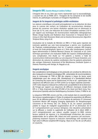 32
N° 16 Avril 2014
Imagerie ORL (Suonita Khung et Lambros Tselikas)
L’imagerie tête et cou, bien que moins représentée que la neuroradiologie,
a couvert lors de ce RSNA 2013  : l’imagerie de l’os temporal et de l’oreille
interne, les pathologies tumorales et l’imagerie thyroïdienne.
Imagerie de l’os temporal et pathologies cochléo-vestibulaires
Les séances scientifiques ont porté principalement sur la réduction de dose
pour le scanner des rochers, où l’utilisation de reconstructions itératives
permet de conserver une bonne résolution spatiale tout en diminuant le
bruit (de 32 %), avec une réduction de la dose d’irradiation estimée à 50 %
par rapport aux techniques de reconstructions habituelles (rétroprojection
filtrée) (Image Quality and Radiation Dose Assessment in Temporal Bone CT
Using an Ultra High Resolution Mode and an Iterative Reconstruction Algorithm
Temporal Bone, Leng et al).
L’évaluation de la maladie de Ménière en IRM à 3 Tesla après injection de
contraste gadoliné par voie trans-tympanique a permis une visualisation
de l’hydrops endolymphatique chez les 12 patients analysés (MR Imaging
of Inner Ear Endo-perilynphatic Spaces at 3 Tesla after Intratympanic Contrast
Agent Administration in Definite Meniere’s Disease, M. Colasurdo et al). Cette
technique permettrait une évaluation fiable des espaces endolymphatiques
sans complication. Une étude sur 153 patients a montré, à l’aide de
reconstructions tridimensionnelles sur une séquence T2 haute résolution, une
diminution du volume du système vestibulaire chez les patients présentant
des vertiges (Volumetric Assessment of the Membranous Vestibular System in
Patients Presenting with Vertigo, N. Naguib et al).
Imagerie oncologique
Des considérations technologiques et de protocole ont constitué les éléments les
plus marquants en imagerie oncologique ORL : présentation de recommandations
pour le contourage en TDM et IRM des organes à risque du larynx avant
radiothérapie pour des cancers ORL (Development of a Standardized Method
for Contouring the Larynx and Its Substructures, M Choi et al) ; optimisation des
séquences de diffusion avec un FOV centré sur la région explorée (zoomée) :
Z-EPI. Cette séquence réduisait les artéfacts de susceptibilité et de la distorsion
de l’image par rapport aux séquences de diffusion classiques (single-shot
EPI) à 3 Tesla (Improved Zoomed EPI-DWI of the Head and Neck Using Two-
dimensional Spatially-selective Radiofrequency Excitation Pulses, P. Riffel et al).
La séquence IVIM-DWI, encore une fois, a été évaluée dans la caractérisation
des tumeurs nasopharyngées à 3 Teslas. En analysant les paramètres de diffusion
pure (D) de diffusion-perfusion (D*) et la fraction de perfusion (f) (Intravoxel
Incoherent Motion MR Imaging: Emerging Applications for Nasopharyngeal
Carcinoma at the Primary Site, S.X. Zhang et al), les auteurs pouvaient
prédire le risque de malignité (augmentation de D* et diminution de D
et f comparativement aux tumeurs bénignes). Une deuxième présentation
sur la diffusion a montré la supériorité de l’utilisation de b élevé (2000 s/
mm2
) comparativement aux valeurs usuelles (jusqu’à b=1000) comme
facteur prédictif de réponse à la chimiothérapie d’induction des cancers
épidermoïdes de la sphère ORL (Head and neck squamous cell carcinoma  :
predicting treatment response to induction chemotherapy with standard and
high value b diffusion weighted MR imaging, I Ryoo et al). Pas de cut-off précis
en revanche.
 