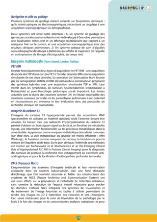 19
Navigation et aide au guidage
Plusieurs systèmes de guidage étaient présents sur l’exposition technique :
qu’ils soient optiques ou électromagnétiques, nécessitant un couplage à une
acquisition scannographique ou échographique.
Deux systèmes ont attiré notre attention  : 1/ un système de guidage des
gestes percutanés sous tomodensitométrie développé à Grenoble, permettant
une localisation temps-réel et un affichage multiplanaire par rapport à un
marqueur fixé sur le patient, et une acquisition scannographique avec des
résultats cliniques prometteurs. 2/ Un système optique de suivi d’aiguilles
sous échographie développé à Baltimore qui affiche la trajectoire de l’aiguille
en surimpression de l’image d’échographie, en temps réel.
Imagerie multimodale (Pierre Durand, Lambros Tselikas)
PET-IRM
Il existe historiquement deux types d’acquisition en PET-IRM : une acquisition
dissociée desTEP d’une part (ou PET-CT) et des données IRM, et une acquisition
simultanée de ces deux données, la correction de l’atténuation étant fournie
par les cartographies DIXON en IRM. Désormais deux constructeurs proposent
des systèmes hybrides avec une acquisition simultanée TEP et IRM. Leur
intérêt dans les lymphomes, les tumeurs neuroendocrines (combinaison à
l’octréotide) et pour l’oncologie pédiatrique paraît important. Les limites
actuelles sont la durée des examens (environ 2h) et l’étude incomplète des
structures osseuses corticales et du parenchyme pulmonaire. Leur potentiel
en neurosciences est immense et leur évaluation dans des protocoles de
recherche clinique est souhaitable.
Imagerie du carbone 13
L’imagerie du carbone 13 hyperpolarisée permet des acquisitions IRM/
spectrométrie en utilisant un matériel standard, seule l’antenne devant être
adaptée. Ce traceur n’est pas radioactif. L’hyperpolarisation du carbone 13
permet d’obtenir un bon rapport signal sur bruit et, en fonction du métabolite
injecté, une information fonctionnelle sur les processus métaboliques dans la
zoneétudiée:lepyruvatecommemarqueurmétaboliquedescellulestumorales
(car chez elles, la voie métabolique du glucose est moins efficiente : effet
Warburg) ; le fumarate comme marqueur de nécrose, le bicarbonate pour la
mesure de l’équilibre acide-base. Sur le plan clinique, l’intérêt de ces méthodes
est montré par Kurhanewicz et al. (Kurhanewicz et al, The Emerging Clinical
Role of Hyperpolarized 13C MR in Prostate Cancer Imaging) pour le diagnostic
des tumeurs de prostate, la recherche d’un échappement au traitement anti-
androgénique et pour la localisation d’adénopathies profondes tumorales.
PACS (Francesco Macri)
L’augmentation des examens d’imagerie médicale et leur numérisation
croissante dans les sociétés industrialisées crée une forte demande
d’archivage, que l’on souhaite sécurisée et fiable. Les constructeurs des
systèmes de PACS (Picture Archiving and Communication System) ont
axé leurs efforts sur la polyvalence et l’intuitivité de l’interface utilisateur,
sans omettre la réduction de l’espace virtuel nécessaire pour stocker
les données. Certains PACS intègrent des systèmes de visualisation et
de traitement de l’image futuristes et faciles à utiliser permettant de
rendre des images en 3D à l’attention des cliniciens et des chirurgiens.
Ceci serait intéressant pour le suivi de l’évolution de la pathologie par le
biais à la fois des images et de concomitantes analyses statistiques et pour
 