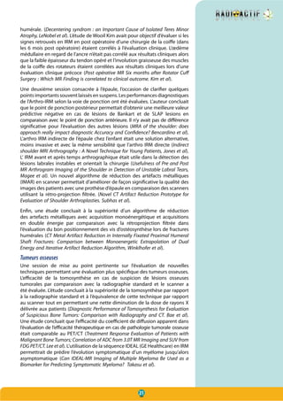 21
humérale. (Decentering syndrom : an Important Cause of Isolated Teres Minor
Atrophy, LeNobel et al). L’étude de Wooil Kim avait pour objectif d’évaluer si les
signes retrouvés en IRM en post opératoire d’une chirurgie de la coiffe (dans
les 6 mois post opératoire) étaient corrélés à l’évaluation clinique. L’œdème
médullaire en regard de l’ancre n’était pas corrélé aux résultats cliniques alors
que la faible épaisseur du tendon opéré et l’involution graisseuse des muscles
de la coiffe des rotateurs étaient corrélées aux résultats cliniques lors d’une
évaluation clinique précoce (Post opérative MR Six months after Rotator Cuff
Surgery : Which MR Finding is correlated to clinical outcome. Kim et al).
Une deuxième session consacrée à l’épaule, l’occasion de clarifier quelques
points importants souvent laissés en suspens. Les performances diagnostiques
de l’Arthro-IRM selon la voie de ponction ont été évaluées. L’auteur concluait
que le point de ponction postérieur permettait d’obtenir une meilleure valeur
prédictive négative en cas de lésions de Bankart et de SLAP lesions en
comparaison avec le point de ponction antérieure. Il n’y avait pas de différence
significative pour l’évaluation des autres lésions (MRA of the shoulder: does
approach really impact diagnostic Accuracy and Confidence? Bencardino et al).
L’arthro IRM indirecte de l’épaule chez l’enfant était une solution alternative,
moins invasive et avec la même sensibilité que l’arthro IRM directe (Indirect
shoulder MRI Arthrography : A Novel Technique for Young Patients, Jones et al).
L‘ IRM avant et après temps arthrographique était utile dans la détection des
lésions labrales instables et orientait la chirurgie (Usefulness of Pre and Post
MR Arthrogram Imaging of the Shoulder in Detection of Unstable Labral Tears,
Magee et al). Un nouvel algorithme de réduction des artéfacts métalliques
(IMAR) en scanner permettait d’améliorer de façon significative la qualité des
images des patients avec une prothèse d’épaule en comparaison des scanners
utilisant la rétro-projection filtrée. (Novel CT Artifact Reduction Prototype for
Evaluation of Shoulder Arthroplasties. Subhas et al).
Enfin, une étude concluait à la supériorité d’un algorithme de réduction
des artefacts métalliques avec acquisition monoénergétique et acquisitions
en double énergie par comparaison avec la rétroprojection filtrée dans
l’évaluation du bon positionnement des vis d’ostéosynthèse lors de fractures
humérales (CT Metal Artifact Reduction in Internally Fixated Proximal Humeral
Shaft Fractures: Comparison between Monoenergetic Extrapolation of Dual
Energy and Iterative Artifact Reduction Algorithm, Winklhofer et al).
Tumeurs osseuses
Une session de mise au point pertinente sur l’évaluation de nouvelles
techniques permettant une évaluation plus spécifique des tumeurs osseuses.
L’efficacité de la tomosynthèse en cas de suspicion de lésions osseuses
tumorales par comparaison avec la radiographie standard et le scanner a
été évaluée. L’étude concluait à la supériorité de la tomosynthèse par rapport
à la radiographie standard et à l’équivalence de cette technique par rapport
au scanner tout en permettant une nette diminution de la dose de rayons X
délivrée aux patients (Diagnostic Performance of Tomosynthesis for Evaluation
of Suspicious Bone Tumors: Comparison with Radiography and CT. Bae  et al).
Une étude concluait que l’efficacité du coefficient de diffusion apparent dans
l’évaluation de l’efficacité thérapeutique en cas de pathologie tumorale osseuse
était comparable au PET/CT (Treatment Response Evaluation of Patients with
Malignant Bone Tumors; Correlation of ADC from 3.0T MR Imaging and SUV from
FDG PET/CT. Lee et al). L’utilisation de la séquence IDEAL (GE Healthcare) en IRM
permettrait de prédire l’évolution symptomatique d’un myélome jusqu’alors
asymptomatique (Can IDEAL-MR Imaging of Multiple Myeloma Be Used as a
Biomarker for Predicting Symptomatic Myeloma?  Takasu et al).
 