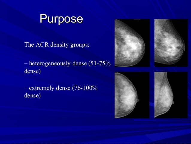 Rsna Van Colen Breast Density Rsna Van Colen Breast Density