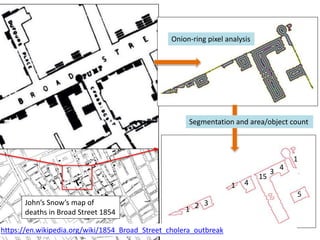 3
4
15
3
4
5
21
1
1
John’s Snow’s map of
deaths in Broad Street 1854
Onion-ring pixel analysis
Segmentation and area/object count
https://en.wikipedia.org/wiki/1854_Broad_Street_cholera_outbreak
 