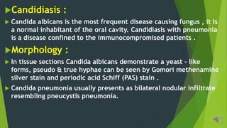 Candidiasis :
Candida albicans is the most frequent disease causing fungus , it is
a normal inhabitant of the oral cavity. Candidiasis with pneumonia
is a disease confined to the immunocompromised patients .
Morphology :
In tissue sections Candida albicans demonstrate a yeast – like
forms, pseudo & true hyphae can be seen by Gomori methenamine
silver stain and periodic acid Schiff (PAS) stain .
Candida pneumonia usually presents as bilateral nodular infiltrate
resembling pneucystis pneumonia.
 