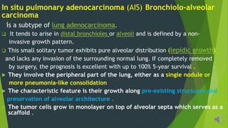 In situ pulmonary adenocarcinoma (AIS) Bronchiolo-alveolar
carcinoma
is a subtype of lung adenocarcinoma.
It tends to arise in distal bronchioles or alveoli and is defined by a non-
invasive growth pattern.
This small solitary tumor exhibits pure alveolar distribution (lepidic growth)
and lacks any invasion of the surrounding normal lung. If completely removed
by surgery, the prognosis is excellent with up to 100% 5-year survival .
They involve the peripheral part of the lung, either as a single nodule or
more pneumonia-like consolidation
The characteristic feature is their growth along pre-existing structures and
preservation of alveolar architecture .
The tumor cells grow in monolayer on top of alveolar septa which serves as a
scaffold .
 
