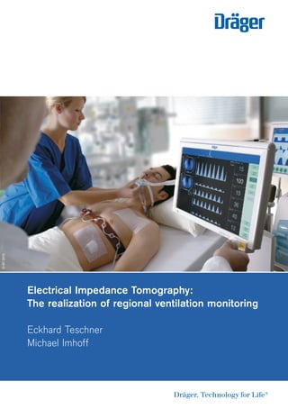 D-87-2010




            Electrical Impedance Tomography:
            The realization of regional ventilation monitoring

            Eckhard Teschner
            Michael Imhoff
 