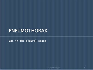 PNEUMOTHORAX
Gas in the pleural space
www.medicinemcq.com 1
 