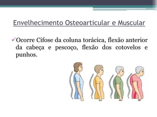 Envelhecimento Osteoarticular e Muscular
Ocorre Cifose da coluna torácica, flexão anterior
da cabeça e pescoço, flexão dos cotovelos e
punhos.
 