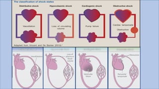 Comprehensive Overview of Shock Types, Pathophysiology, and Management ...