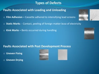 Faults Associated with Loading and Unloading
o Film Adhesion – Cassette adhered to intensifying lead screens
o Static Marks - Contact, peeling of foreign matter bcoz of electricity
o Kink Marks – Bents occurred during handling
Faults Associated with Post Development Process
o Uneven Fixing
o Uneven Drying
Types of Defects
 