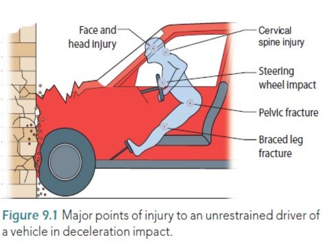 driver injury patternக்கான பட முடிவுகள்