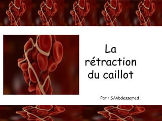 A/S
La rétraction du caillotLa
rétraction
du caillot
Par : S/Abdessemed
 