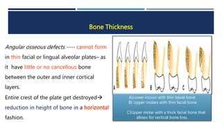 Layer Bone Problems BONE LOSS PATTERN in periodontal diseasepptx | PPTX