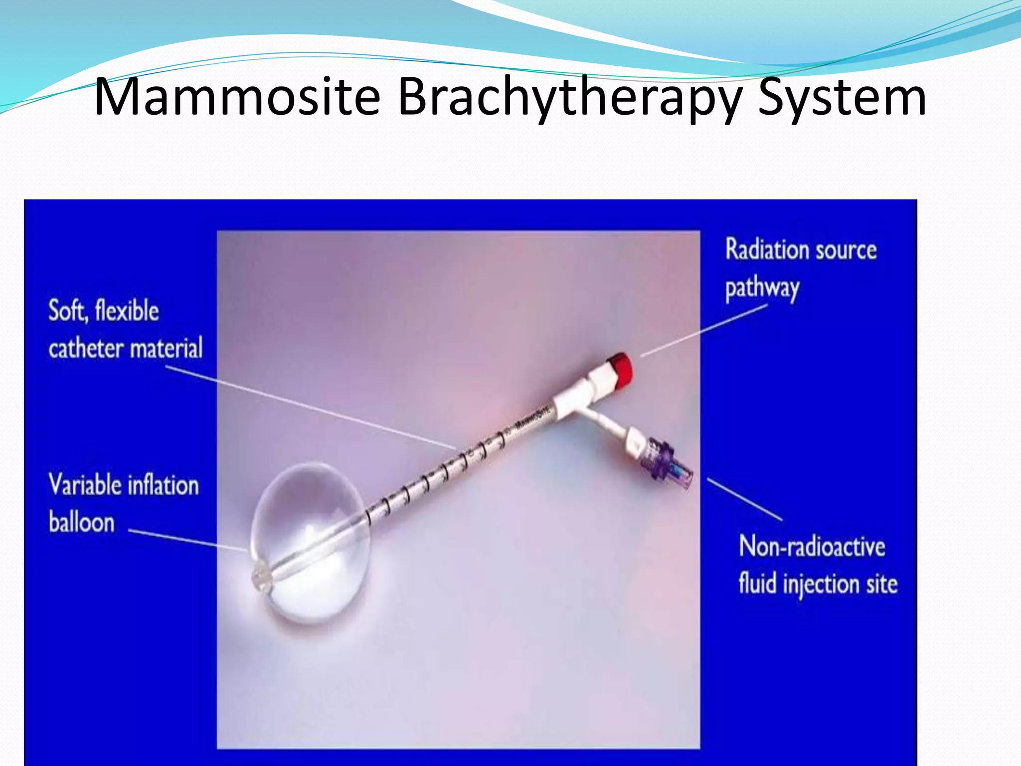 RT breast apbi | PPTX