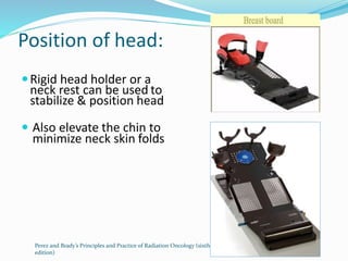Radiotherapy breast | PPTX