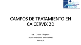 CAMPOS DE TRATAMIENTO EN
CA CERVIX 2D
MR1 Crislee E Lopez C
Departamento de Radioterapia
IREN SUR
 