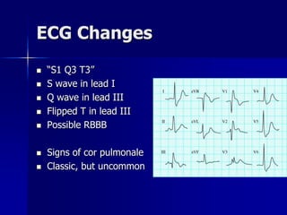 ECG Changes
 “S1 Q3 T3”
 S wave in lead I
 Q wave in lead III
 Flipped T in lead III
 Possible RBBB
 Signs of cor pulmonale
 Classic, but uncommon
 