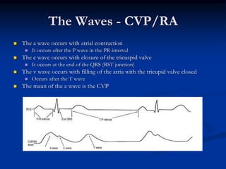 RTC PA CATHETER.ppt