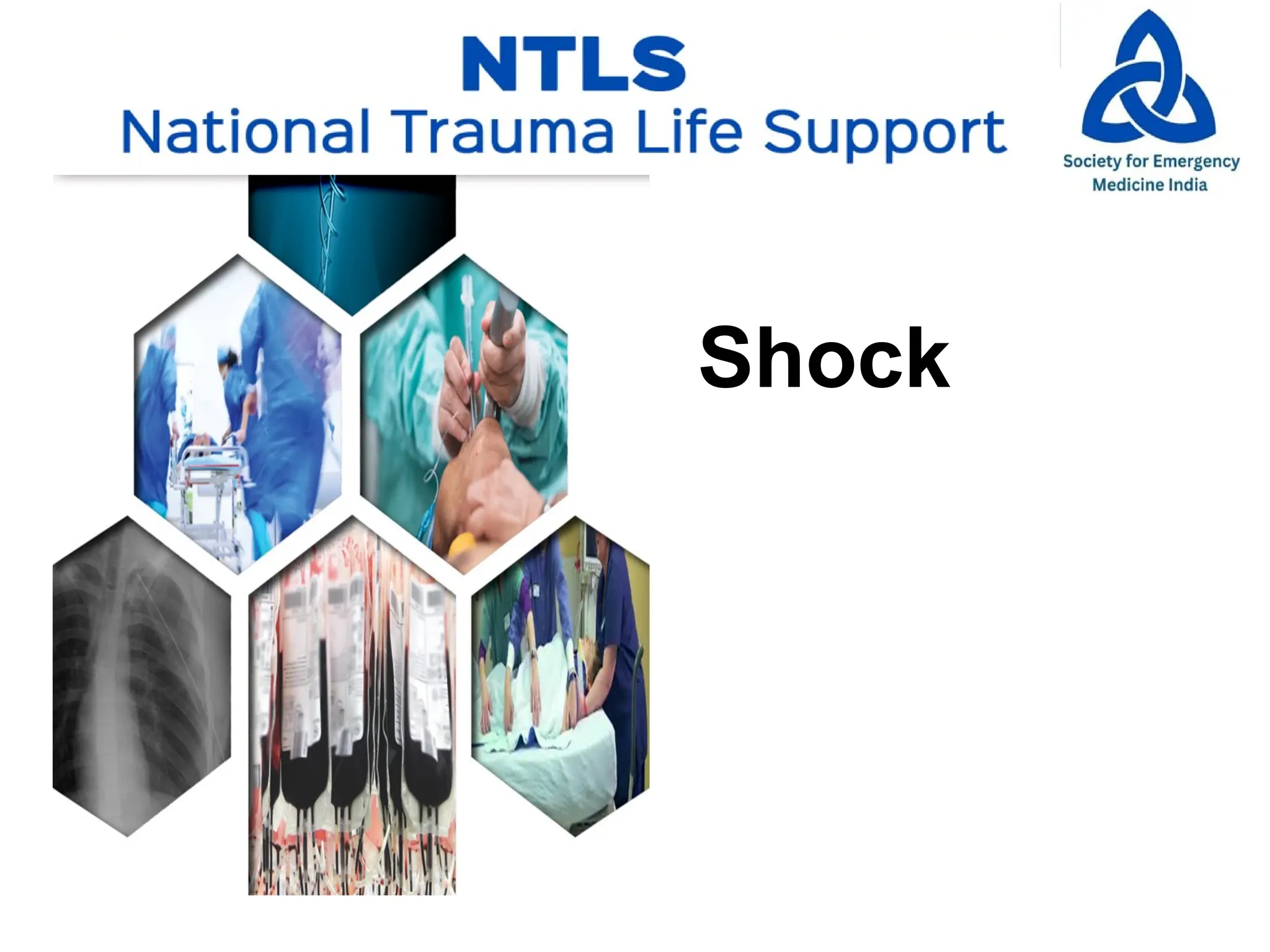 RTC SHOCK in trauma is dangerous and can kill | PPTX