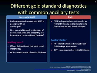 5

    Different gold standard diagnostics
        with common ancillary tests
             Neovascular AMD                                                                     DME
   Early detection of neovascular AMD is                           DME is diagnosed stereoscopically as
    possible with an                                                 retinal thickening in the macula using
    Amsler grid1                                                     fundus contact lens biomicroscopy3
   FA is essential to confirm diagnosis of
    neovascular AMD, and to identify the
    location and composition of the CNV1

                                                                Ancillary tests:3
Ancillary tests:2
                                                                    FA – identification and evaluation of
   ICGA – delineation of choroidal vessel                           fluid leakage from lesions
    morphology
                                                                    OCT – measurement of retinal thickness
   OCT – measurement of retinal thickness




                                                                                          1. Sickenberg M. Ophthalmologica 2001;215:247–253
                                                             2. The Royal College of Ophthalmologists. AMD: guidelines for management. 2009.
                                http://www.rcophth.ac.uk/docs/publications/AMD_GUIDELINES_FINAL_VERSION_Feb_09.pdf [accessed Sep 2009]
                                                                                                3. Bhagat N et al. Surv Ophthalmol 2009;54:1–32
 