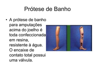 Prótese de Banho
• A prótese de banho
para amputações
acima do joelho é
toda confeccionada
em resina,
resistente à água.
O encaixe de
contato total possui
uma válvula.
 