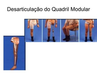 Desarticulação do Quadril Modular
 