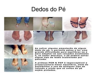 Dedos do Pé
 