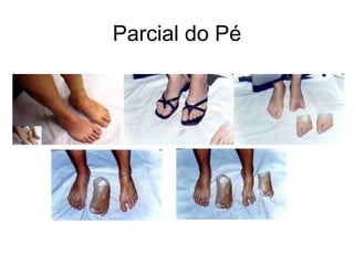 Parcial do Pé
 