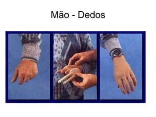 Mão - Dedos
 